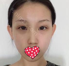 南京华美美容医院（旗舰店）许恺燕医生怎么样