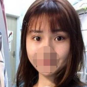 南京华美美容医院陈刚医生怎么样