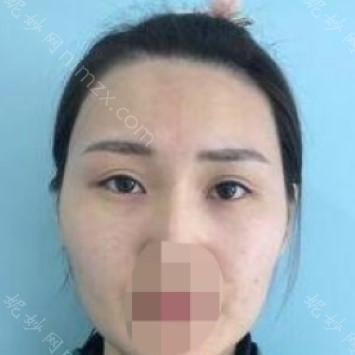 南京华美美容医院陈刚医生怎么样
