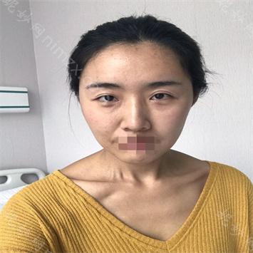 昆明艺星医疗整形医院王艳芬医生怎么样