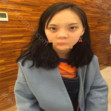 南京华美医疗美容整形医院曹海峰隆鼻怎么样