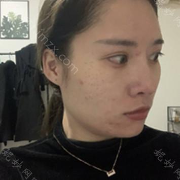 金华丽都整形舒露英医生怎么样