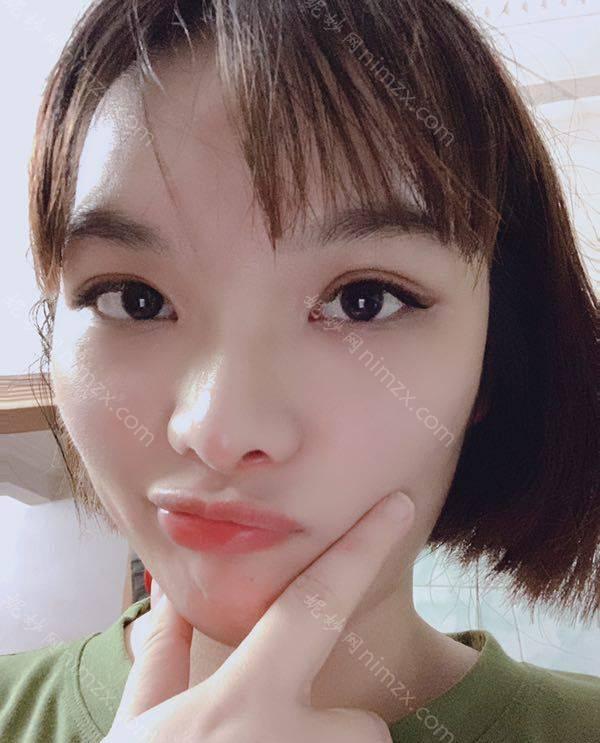 天津哪家医院做内切去眼袋手术较好？正规排名榜盘点前四_价格清单一一出示!！