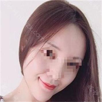 南京华美整形美容医院曹海峰垫下巴怎么样