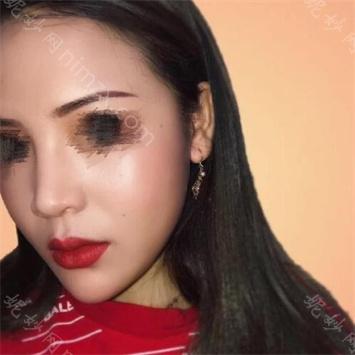 南京华美整形美容医院曹海峰怎么样