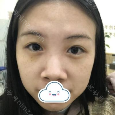 昆明吴氏嘉美医疗整形医院嘉美沈小铃医生怎么样