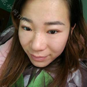天津哪家医院做玻尿酸填充泪沟较好？医美4强全新阵容一一介绍_整形价格查询！
