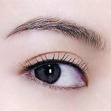 南京华美美容医院沈正宇双眼皮做得好吗