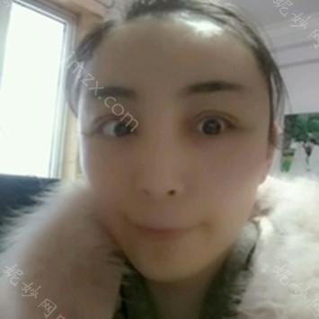 南京华美美容医院沈正宇脂肪填充怎么样