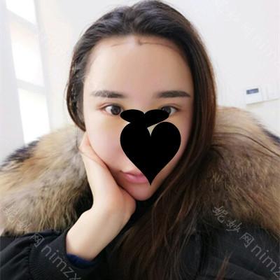 昆明艺星医疗整形医院单志春医生怎么样