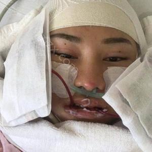 天津哪家医院做下巴截骨术比较靠谱？这几家预约量高口碑好_价格透明！