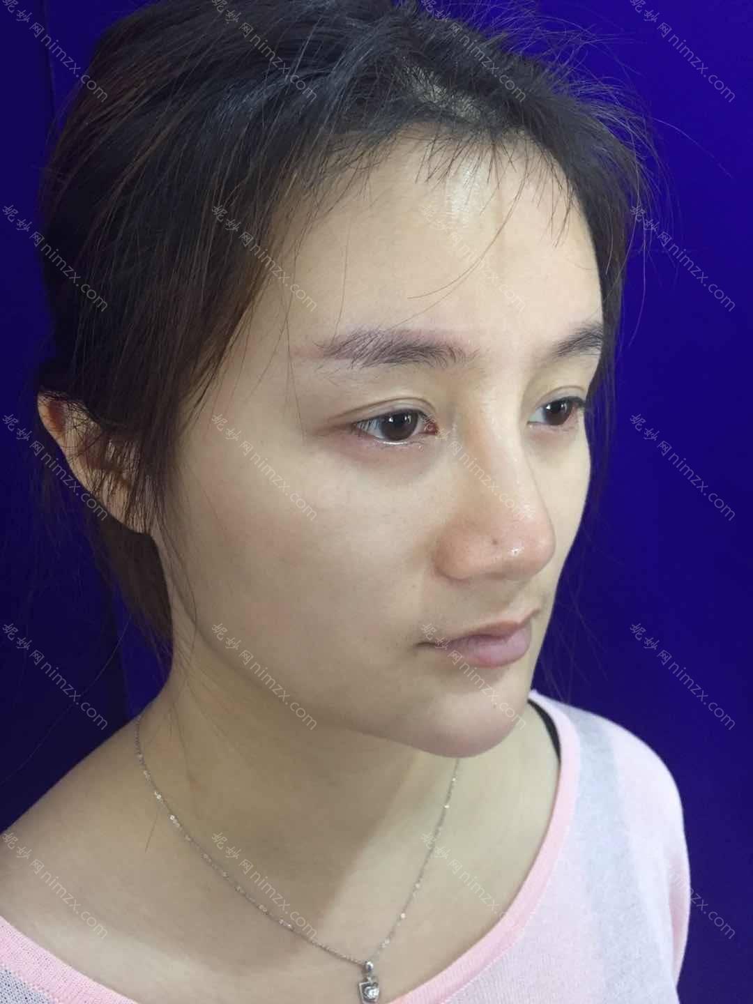 天津哪家医院做下颌角手术较好？排行前三不仅看医院实力！