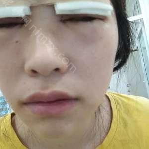 天津哪家医院做无痕开眼角效果比价好？排名前三晗熙、天津河东丽人医院、和平薇什都有资质_专家实力不浅!！