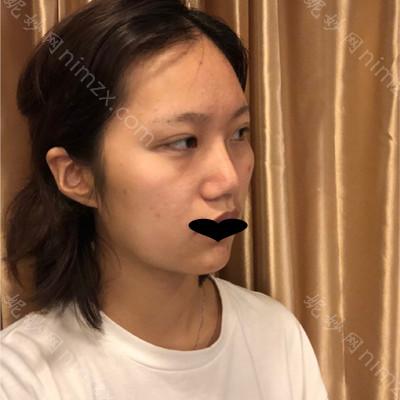 云南华美美莱美容医院美莱王睿恒医生怎么样