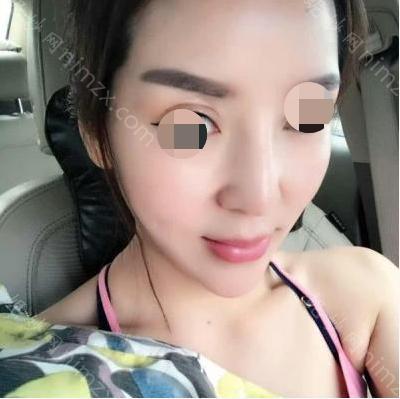 云南华美美莱美容医院毕丽医生怎么样