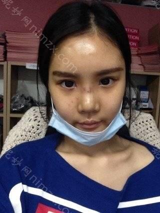 天津哪家医院做内眼角修复效果好？排名前十强口碑亮眼~送上案例及价格表做比较！