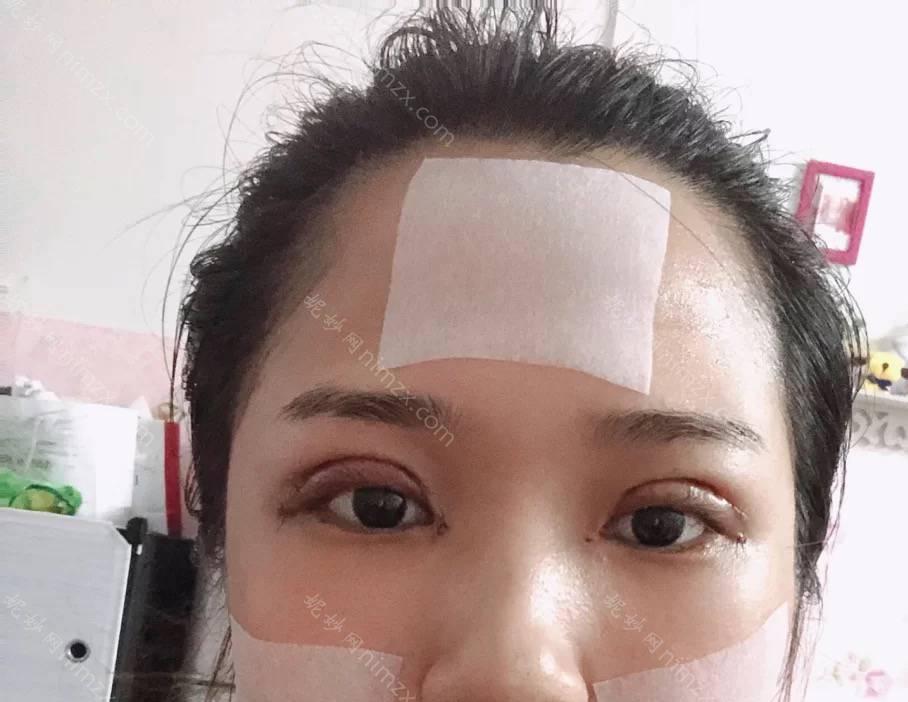 天津哪家医院做开外眼角好看？排名前五医院评点_附手术价格查询！