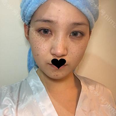 绵阳茗汇医疗整形美容医院未小娅医生怎么样