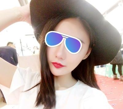 南充阿蓝医疗美容整形门诊部雷晓东做鼻综合好吗