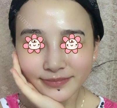 云南铜雀台整形美容医院台赵兰明医生怎么样