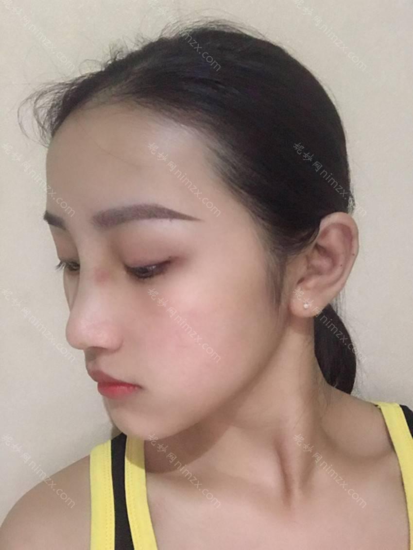 广东哪家医院做耳软骨复合隆鼻比较好？正规排名榜盘点前四_价格清单一一出示!！