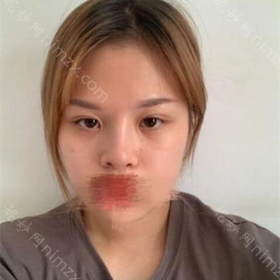 兰州皙妍丽医疗美容门诊部丽马振峰医生怎么样