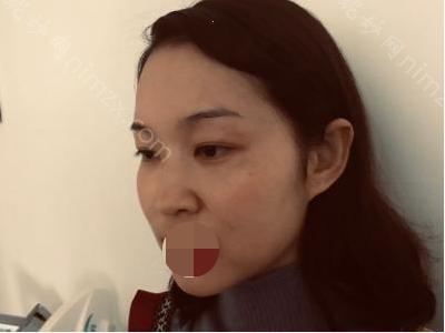 兰州皙妍丽整形美容门诊部丽刘姗医生怎么样