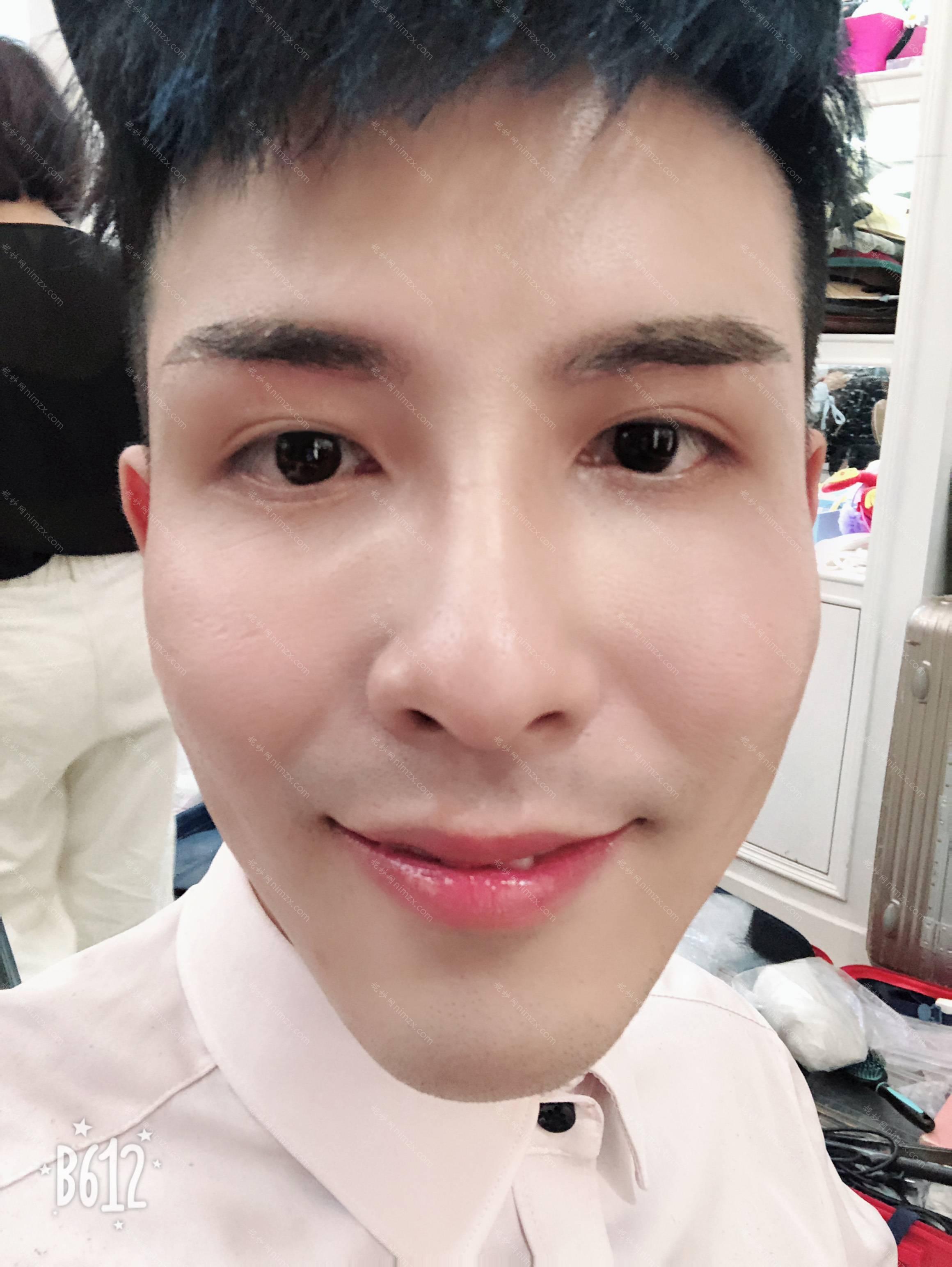 广东哪家医院做眼睑矫正正规？全国排名前五医院来对比!价格(多少钱)参考！