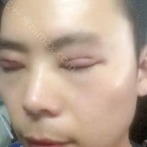 广东哪家医院做眼睑矫正正规？全国排名前五医院来对比!价格(多少钱)参考！