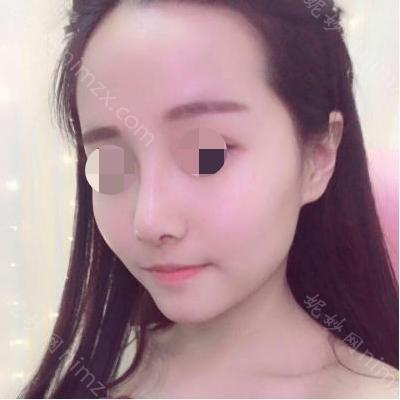 兰州皙妍丽美容整形门诊部丽韩纪东医生怎么样