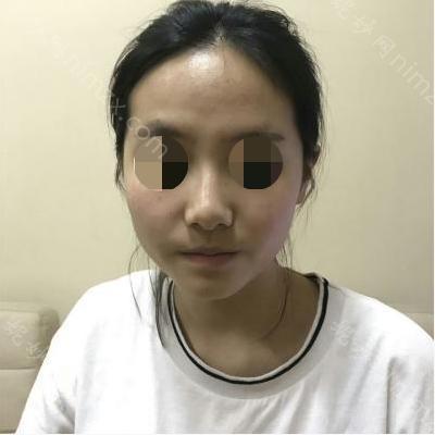兰州皙妍丽美容整形门诊部丽韩纪东医生怎么样