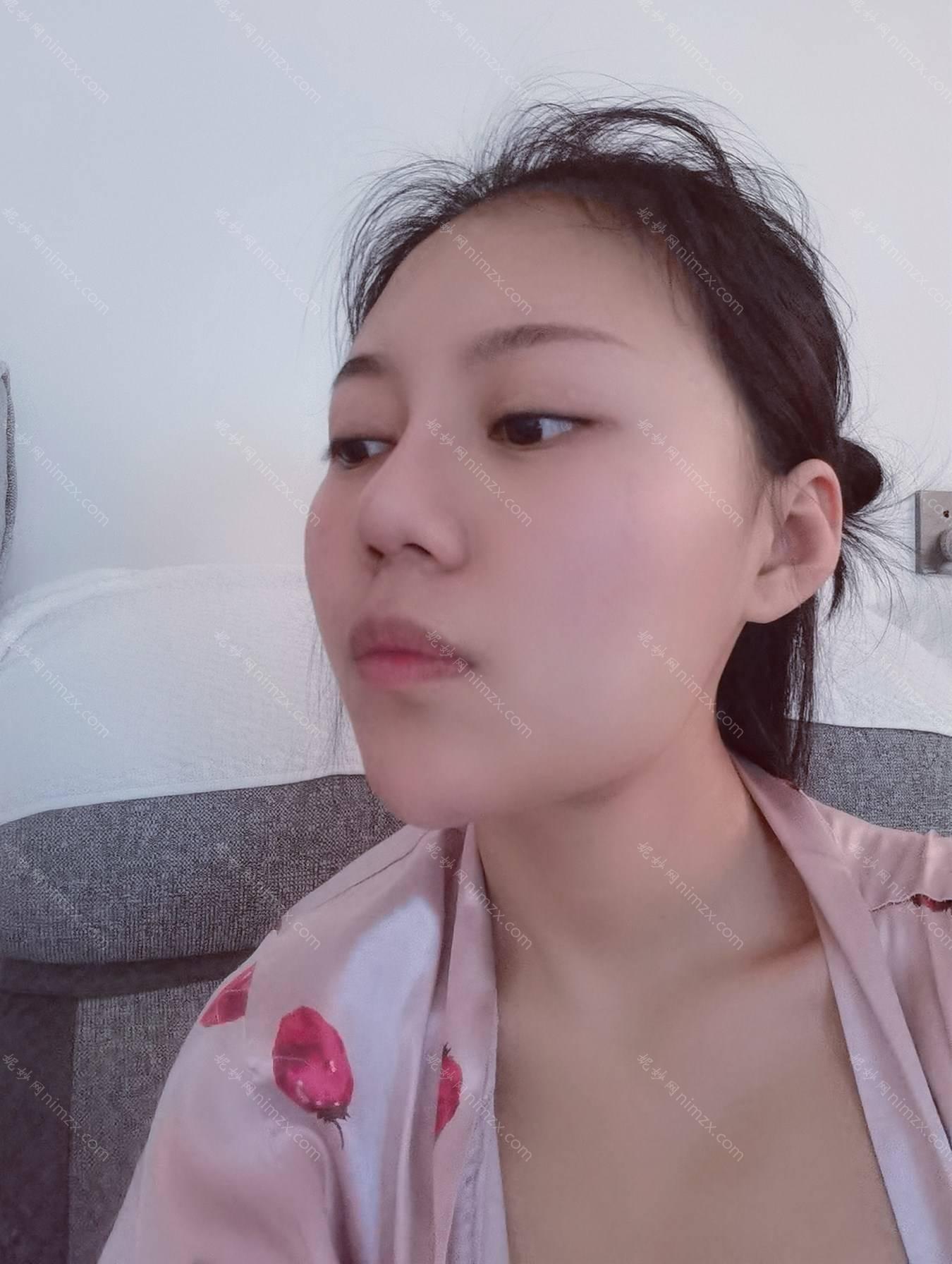 广东哪家医院做线雕隆鼻手术较好？排名前四权威医美口碑盘点_含手术价格查询！