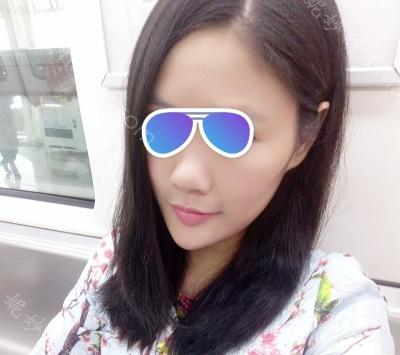 南充阿蓝医疗美容整形门诊部雷晓东做鼻综合好吗