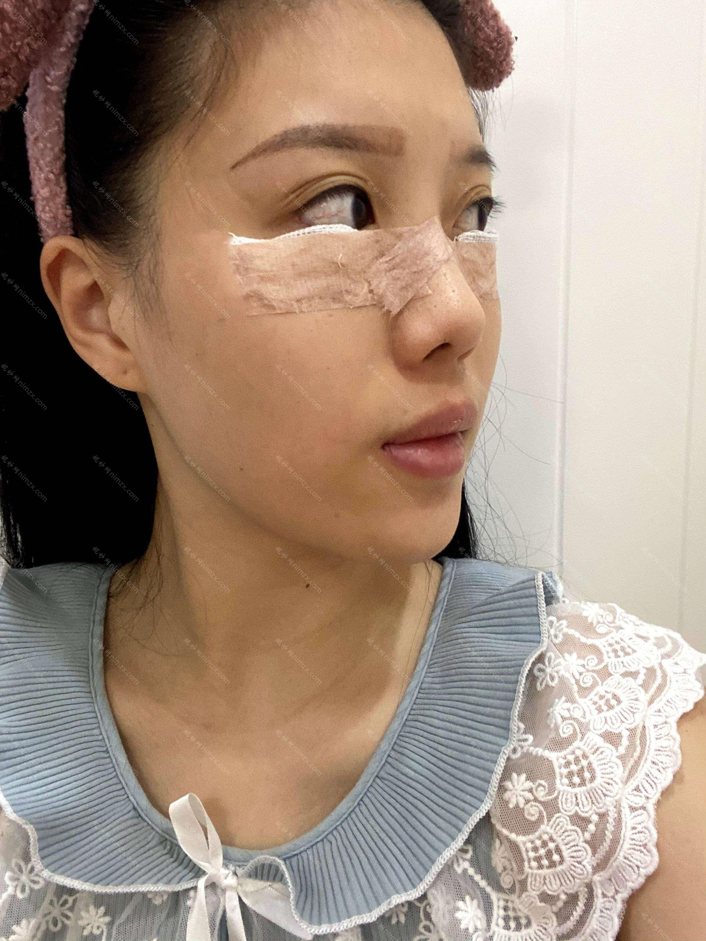 天津哪家医院做去眼袋比较靠谱？河东美泽、时光、圣韩美等实力在线比较!！