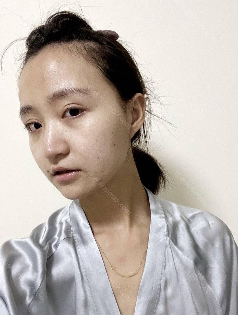 天津哪家医院做去眼袋比较靠谱？河东美泽、时光、圣韩美等实力在线比较!！