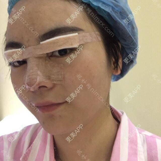 广东哪家医院做垫鼻尖手术较好？排行榜红十字会、禾丽、军美等权威发布!！