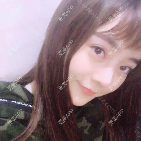 广东哪家医院做垫鼻尖手术较好？排行榜红十字会、禾丽、军美等权威发布!！