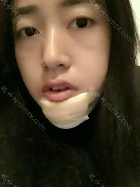 天津哪家医院做下巴整形手术好？10强医院口碑特色各不同~价格收费合理！