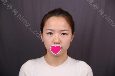 柳州华美医疗美容门诊部胡晓波医生怎么样
