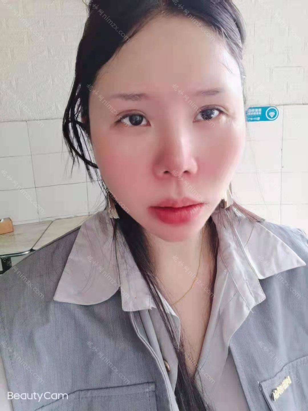 天津哪家医院做瘦脸*较专业？排名榜整理5位医院大咖!华美、天津市宝坻区中医医院、天津华山医院等任选！