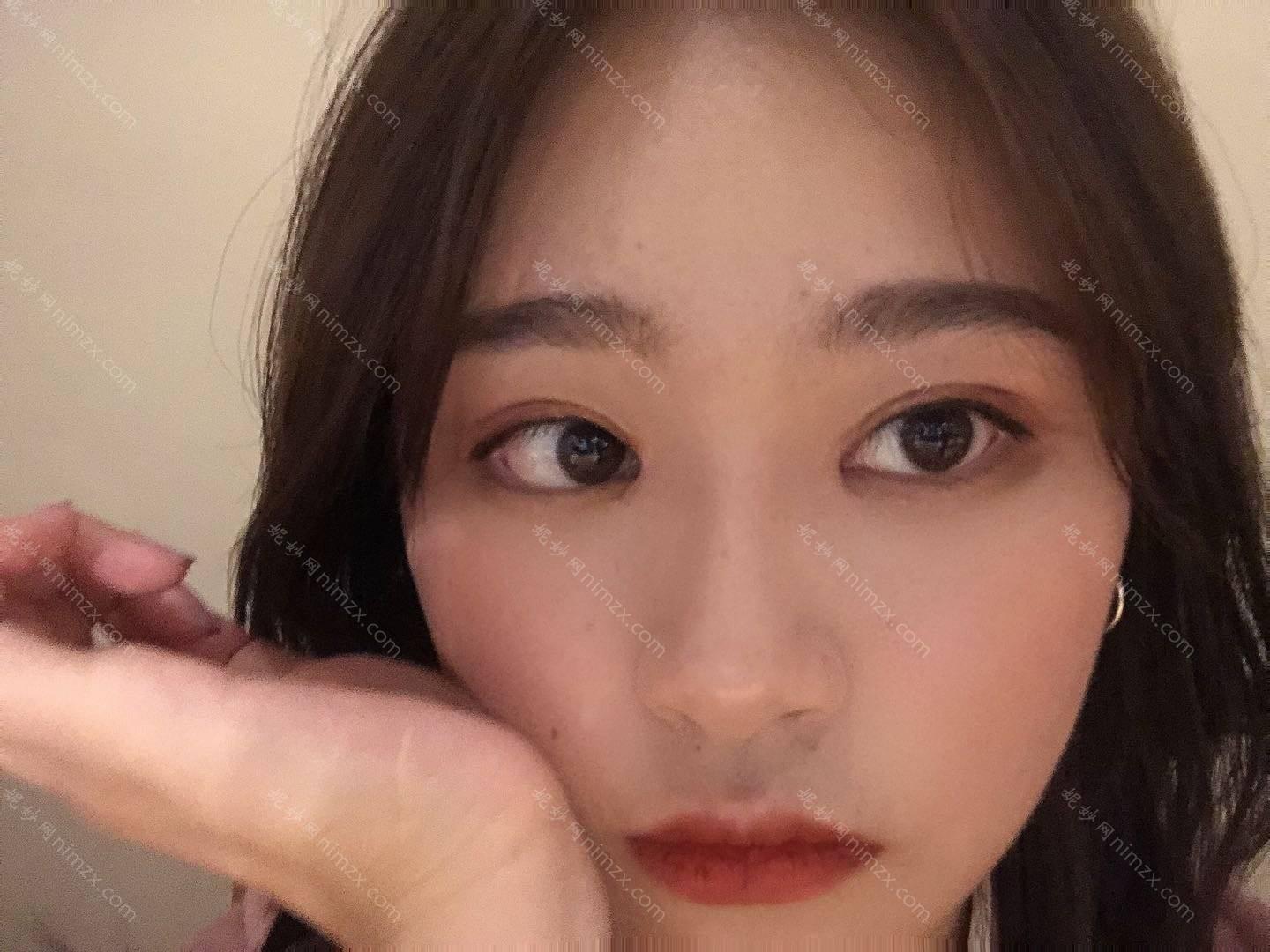 天津哪家医院做瘦脸*较专业？排名榜整理5位医院大咖!华美、天津市宝坻区中医医院、天津华山医院等任选！