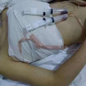 安徽哪家医院做乳晕缩小手术较好？2021排行前10盘点!个个都是口碑好且人气高_案例和价格同步！