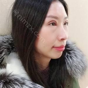 天津哪家医院做韩式双眼皮手术较好？排行榜河东菲丝澜、麦思美尔、天津公安医院等权威发布!！