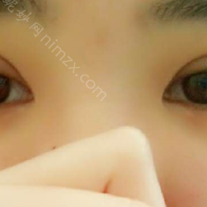 广东哪家医院做眼袋修复较专业？全国排名前五医院来对比!价格(多少钱)参考！
