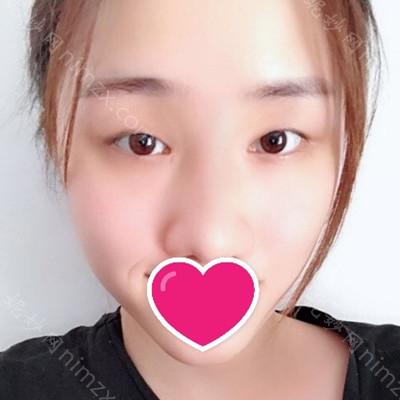 南充阿蓝整形医院沙新力怎么样