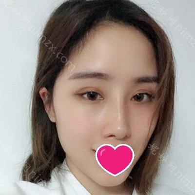 南充阿蓝整形医院沙新力怎么样