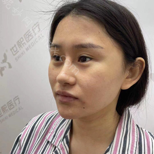 广东哪家医院做鼻型矫正手术好？正规排名榜盘点前四_价格清单一一出示!！