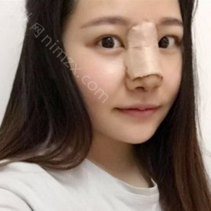 广东哪家医院做鼻型矫正手术好？正规排名榜盘点前四_价格清单一一出示!！