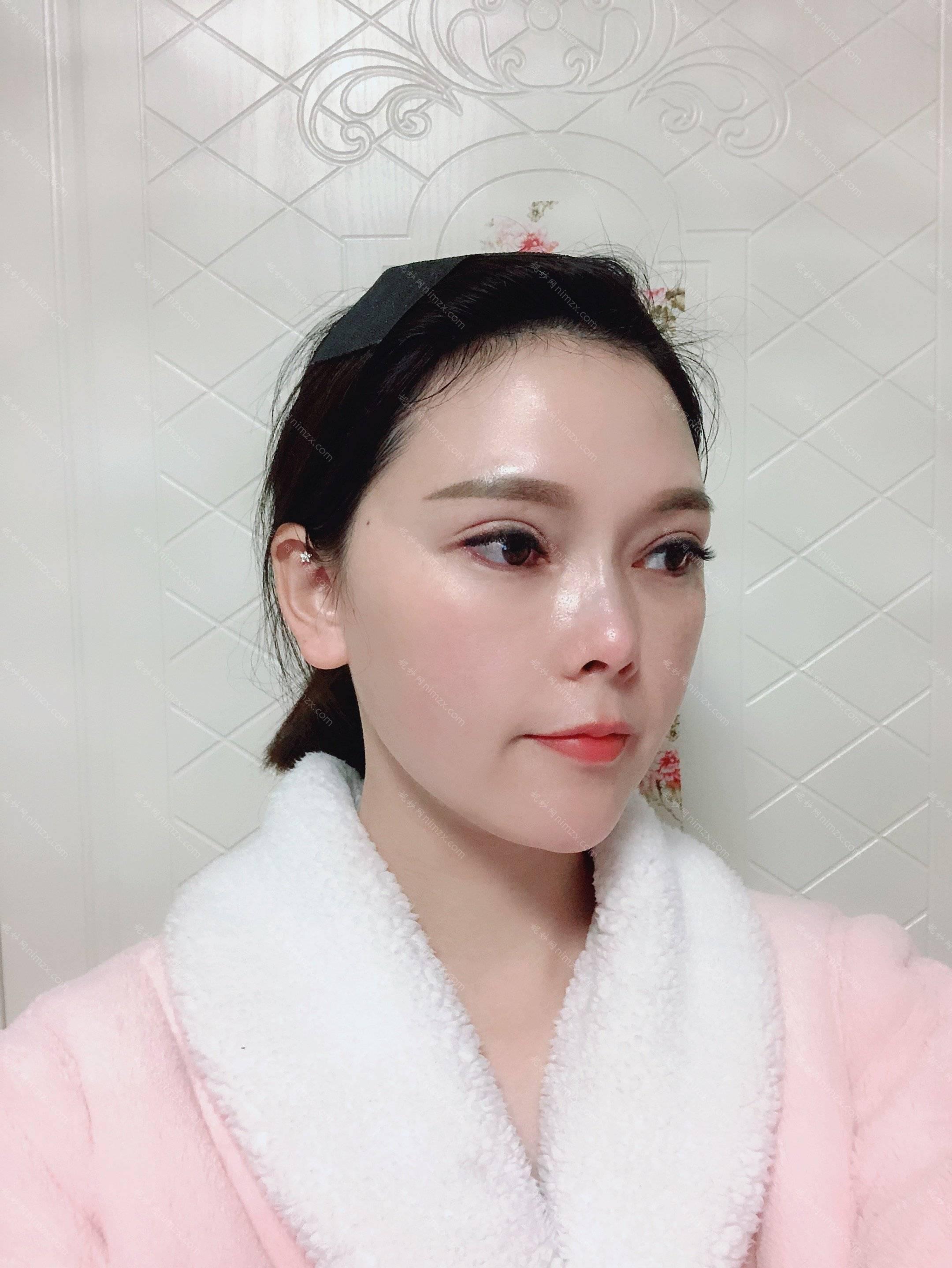 天津哪家医院做去颊脂垫瘦脸靠谱？这几家预约量高口碑好_价格透明！