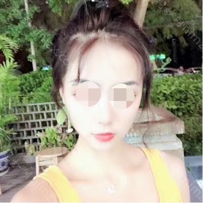 兰州皙妍丽医疗美容整形门诊部丽马振峰主任瘦脸*打得怎么样